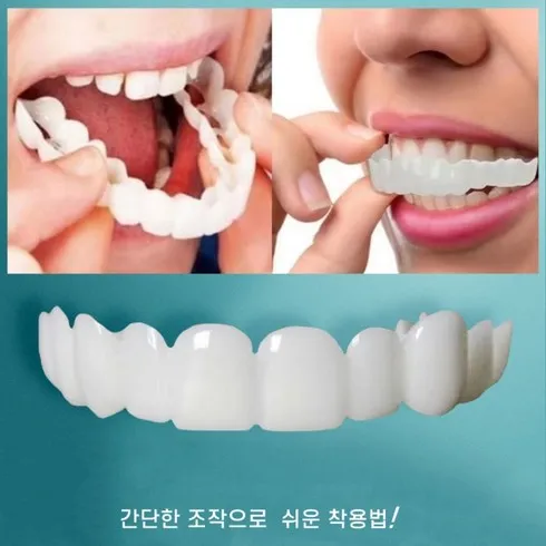 가짜치아 할인 후기